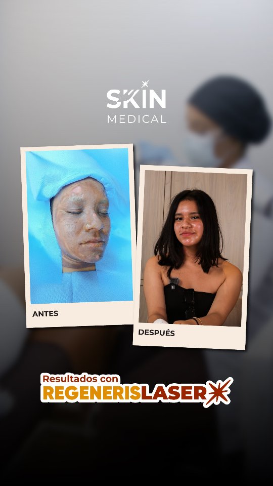 Instagram post shared by @skinmedicaloficial