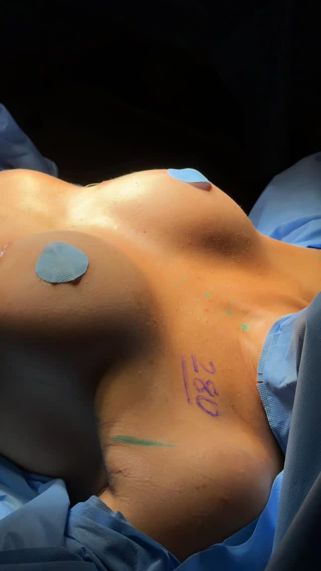 Instagram post shared by @drmarcuscapanema